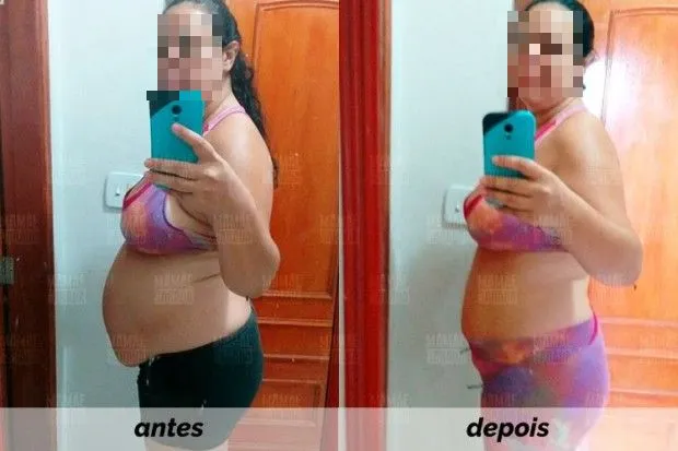 ante-e-depois3_censored.webp